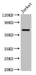 Western Blot | Positive WB detected in: Jurkat whole cell lysate | All lanes: SLC38A9 antibody at 3.5μg/ml | Secondary | Goat polyclonal to rabbit IgG at 1/50000 dilution | Predicted band size: 64, 53, 57 kDa | Observed band size: 64 kDaRabbit anti-Human SLC38A9 Polyclonal Antibody