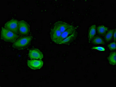 Immunofluorescent analysis of A549 cells using WDR19 Antibody at dilution of 1:100 and Alexa Fluor 488-congugated AffiniPure Goat Anti-Rabbit IgG(H+L)Rabbit anti-Human WDR19 Polyclonal Antibody