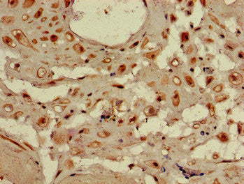 Immunohistochemistry of paraffin-embedded human placenta tissue using the antibody at dilution of 1:100Rabbit anti-Human WDR19 Polyclonal Antibody
