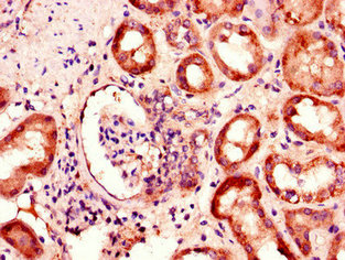 Immunohistochemistry of paraffin-embedded human kidney tissue using BBS1 Antibody at dilution of 1:100