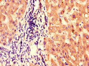 Immunohistochemistry of paraffin-embedded human liver tissue using BBS1 Antibody at dilution of 1:100