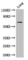 Western Blot | Positive WB detected in: Mouse lung tissue | All lanes: BBS1 antibody at 1μg/ml | Secondary | Goat polyclonal to rabbit IgG at 1/50000 dilution | Predicted band size: 66, 70, 50 kDa | Observed band size: 66 kDa
