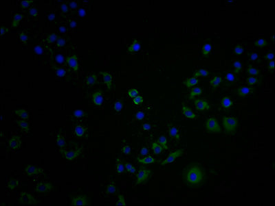 Immunofluorescence staining of A549 cells with OR4C15 Antibody at 1:100, counter-stained with DAPI. The cells were fixed in 4% formaldehyde and blocked in 10% normal Goat Serum. The cells were then incubated with the antibody overnight at 4°C. The secondary antibody was Alexa Fluor 488-congugated AffiniPure Goat Anti-Rabbit IgG(H+L).Rabbit anti-Human OR4C15 Polyclonal Antibody