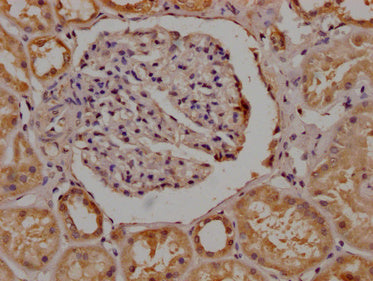 IHC image of OR4C15 Antibody diluted at 1:200 and staining in paraffin-embedded human kidney tissue performed on a Leica BondTM system. After dewaxing and hydration, antigen retrieval was mediated by high pressure in a citrate buffer (pH 6.0). Section was blocked with 10% normal goat serum 30min at RT. Then primary antibody (1% BSA) was incubated at 4°C overnight. The primary is detected by a Goat anti-rabbit polymer IgG labeled by HRP and visualized using 0.05% DAB.Rabbit anti-Human OR4C15 Polyclonal Antibody