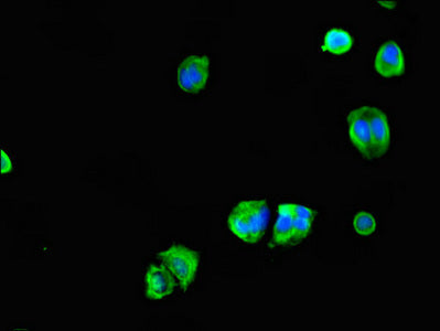 Immunofluorescent analysis of MCF-7 cells using CEP70 Antibody at dilution of 1:100 and Alexa Fluor 488-congugated AffiniPure Goat Anti-Rabbit IgG(H+L)Rabbit anti-Human CEP70 Polyclonal Antibody