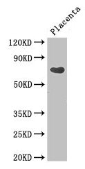 Western Blot  | Positive WB detected in: Human placenta tissue  | All lanes: CEP70 antibody at 3.4µg/ml  | Secondary  | Goat polyclonal to rabbit IgG at 1/50000 dilution  | Predicted band size: 70, 65, 26, 68 kDa  | Observed band size: 70 kDaRabbit anti-Human CEP70 Polyclonal Antibody