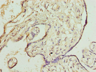 Immunohistochemistry of paraffin-embedded human placenta tissue using DNAJB8 Antibody at dilution of 1:100Rabbit anti-Human DNAJB8 Polyclonal Antibody
