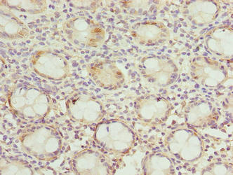 Immunohistochemistry of paraffin-embedded human colon tissue using DNAJB8 Antibody at dilution of 1:100Rabbit anti-Human DNAJB8 Polyclonal Antibody