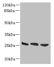 Western blot  | All lanes: DNAJB8 antibody at 8µg/ml  | Lane 1: Hela whole cell lysate  | Lane 2: Mouse brain tissue  | Lane 3: Mouse liver tissue  | Secondary  | Goat polyclonal to rabbit IgG at 1/10000 dilution  | Predicted band size: 26 kDa  | Observed band size: 26 kDaRabbit anti-Human DNAJB8 Polyclonal Antibody