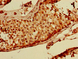 Immunohistochemistry of paraffin-embedded human testis tissue using BRSK1 Antibody at dilution of 1:100Rabbit anti-Human BRSK1 Polyclonal Antibody
