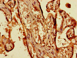 Immunohistochemistry of paraffin-embedded human placenta tissue using BRSK1 Antibody at dilution of 1:100Rabbit anti-Human BRSK1 Polyclonal Antibody