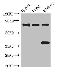 Western Blot | Positive WB detected in: Mouse heart tissue, Mouse lung tissue, Mouse kidney tissue | All lanes: BRSK1 antibody at 3.5μg/ml | Secondary | Goat polyclonal to rabbit IgG at 1/50000 dilution | Predicted band size: 86, 87, 39 kDa | Observed band size: 86, 39 kDa