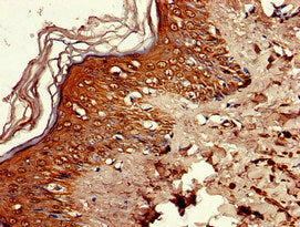 Immunohistochemistry of paraffin-embedded human skin tissue using RNASEH2C Antibody at dilution of 1:100Rabbit anti-Human RNASEH2C Polyclonal Antibody