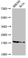 Western Blot | Positive WB detected in: HEK293 whole cell lysate, Hela whole cell lysate | All lanes: RNASEH2C antibody at 3μg/ml | Secondary | Goat polyclonal to rabbit IgG at 1/50000 dilution | Predicted band size: 18 kDa | Observed band size: 18 kDaRabbit anti-Human RNASEH2C Polyclonal Antibody
