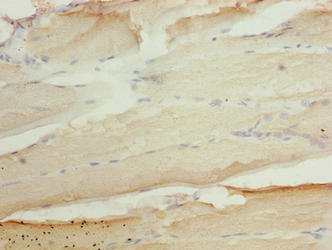 Immunohistochemistry of paraffin-embedded human skeletal muscle tissue using ASAP3 Antibody at dilution of 1:100Rabbit anti-Human ASAP3 Polyclonal Antibody