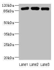 Western blot  | All lanes: ASAP3 antibody at 1µg/ml  | Lane 1: A549 whole cell lysate  | Lane 2: MCF-7 whole cell lysate  | Lane 3: K562 whole cell lysate  | Secondary  | Goat polyclonal to rabbit IgG at 1/10000 dilution  | Predicted band size: 100, 44, 98 kDa  | Observed band size: 100 kDa