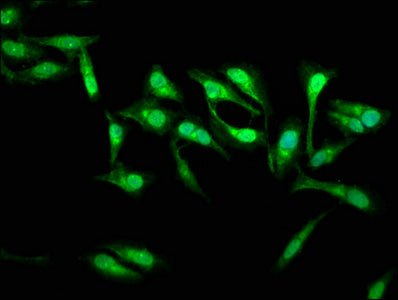 Immunofluorescence staining of Hela cells with SSH3 Antibody at 1:133, counter-stained with DAPI. The cells were fixed in 4% formaldehyde, permeabilized using 0.2% Triton X-100 and blocked in 10% normal Goat Serum. The cells were then incubated with the antibody overnight at 4°C. The secondary antibody was Alexa Fluor 488-congugated AffiniPure Goat Anti-Rabbit IgG(H+L).Rabbit anti-Human SSH3 Polyclonal Antibody