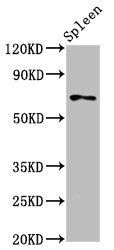Western Blot | Positive WB detected in: Rat spleen tissue | All lanes: SSH3 antibody at 5.3μg/ml | Secondary | Goat polyclonal to rabbit IgG at 1/50000 dilution | Predicted band size: 73, 53, 57, 43, 17 kDa | Observed band size: 73 kDaRabbit anti-Human SSH3 Polyclonal Antibody