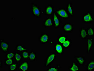 Immunofluorescent analysis of A549 cells using ZDHHC1 Antibody at dilution of 1:100 and Alexa Fluor 488-congugated AffiniPure Goat Anti-Rabbit IgG(H+L)Rabbit anti-Human ZDHHC1 Polyclonal Antibody