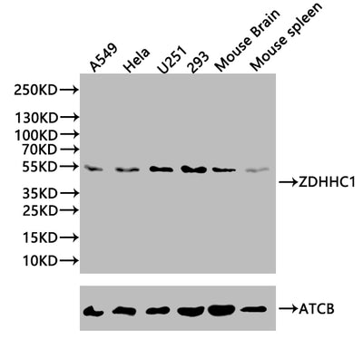 Western Blot | Positive WB detected in: Mouse spleen tissue | All lanes: C16orf1 antibody at 2.6μg/ml | Secondary | Goat polyclonal to rabbit IgG at 1/50000 dilution | Predicted band size: 55 kDa | Observed band size: 55 kDaRabbit anti-Human ZDHHC1 Polyclonal Antibody