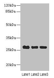Western blot  | All lanes: C10orf82 antibody at 1µg/ml  | Lane 1: A431 whole cell lysate  | Lane 2: HepG2 whole cell lysate  | Lane 3: Mouse thymus tissue  | Secondary  | Goat polyclonal to rabbit IgG at 1/10000 dilution  | Predicted band size: 27, 18, 13 kDa  | Observed band size: 27 kDa