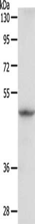 Gel: 8%SDS-PAGE, Lysate: 40 μg, Lane: Human fetal brain tissue, Primary antibody: GDI1 Antibody(GDI1 Antibody) at dilution 1/400, Secondary antibody: Goat anti rabbit IgG at 1/8000 dilution, Exposure time: 3 secondsRabbit anti-Human GDI1 Polyclonal Antibody