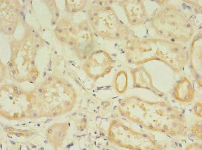 Immunohistochemistry of paraffin-embedded human kidney tissue using RPGR Antibody at dilution of 1:100Rabbit anti-Human RPGR Polyclonal Antibody
