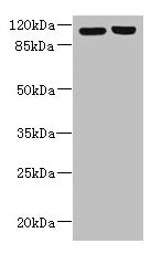 Western blot  | All lanes: RPGR antibody at 6µg/ml  | Lane 1: 293T whole cell lysate  | Lane 2: Hela whole cell lysate  | Secondary  | Goat polyclonal to rabbit IgG at 1/10000 dilution  | Predicted band size: 114, 91, 71, 84, 53, 128 kDa  | Observed band size: 114 kDaRabbit anti-Human RPGR Polyclonal Antibody