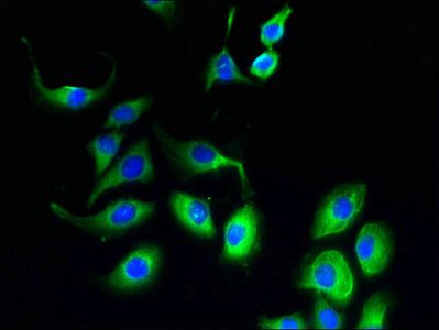Immunofluorescent analysis of A549 cells using FATE1 Antibody at dilution of 1:100 and Alexa Fluor 488-congugated AffiniPure Goat Anti-Rabbit IgG(H+L)Rabbit anti-Human FATE1 Polyclonal Antibody