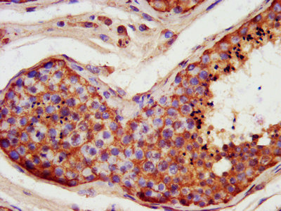 IHC image of the antibody diluted at 1:400 and staining in paraffin-embedded human testis tissue performed on a Leica BondTM system. After dewaxing and hydration, antigen retrieval was mediated by high pressure in a citrate buffer (pH 6.0). Section was blocked with 10% normal goat serum 30min at RT. Then primary antibody (1% BSA) was incubated at 4°C overnight. The primary is detected by a biotinylated secondary antibody and visualized using an HRP conjugated SP system.Rabbit anti-Human FATE1 Polyclonal Antibody