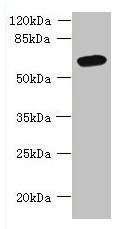 Western blot  | All lanes: FAM149B1 antibody at 3µg/ml + Mouse liver tissue  | Secondary  | Goat polyclonal to rabbit IgG at 1/10000 dilution  | Predicted band size: 65, 59 kDa  | Observed band size: 65 kDaRabbit anti-Human FAM149B1 Polyclonal Antibody