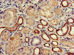 Immunohistochemistry of paraffin-embedded human kidney tissue using COQ8B Antibody at dilution of 1:100Rabbit anti-Human COQ8B Polyclonal Antibody