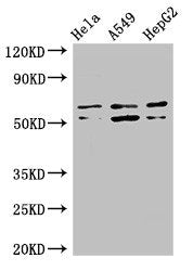 Western Blot  | Positive WB detected in: Hela whole cell lysate, A549 whole cell lysate, HepG2 whole cell lysate  | All lanes: COQ8B antibody at 3μg/ml  | Secondary  | Goat polyclonal to rabbit IgG at 1/50000 dilution  | Predicted band size: 61, 56 kDa  | Observed band size: 61, 56 kDaRabbit anti-Human COQ8B Polyclonal Antibody