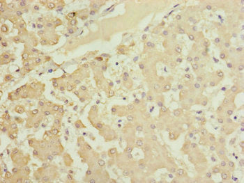 Immunohistochemistry of paraffin-embedded human liver tissue using HOOK2 Antibody at dilution of 1:100Rabbit anti-Human HOOK2 Polyclonal Antibody