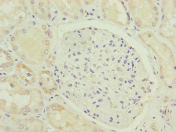 Immunohistochemistry of paraffin-embedded human kidney tissue using HOOK2 Antibody at dilution of 1:100Rabbit anti-Human HOOK2 Polyclonal Antibody