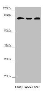 Western blot  | All lanes: HOOK2 antibody at 3.91µg/ml  | Lane 1: Mouse large intestine tissue  | Lane 2: Mouse stomach tissue  | Lane 3: A431 whole cell lysate  | Secondary  | Goat polyclonal to rabbit IgG at 1/10000 dilution  | Predicted band size: 83 kDa  | Observed band size: 83 kDaRabbit anti-Human HOOK2 Polyclonal Antibody