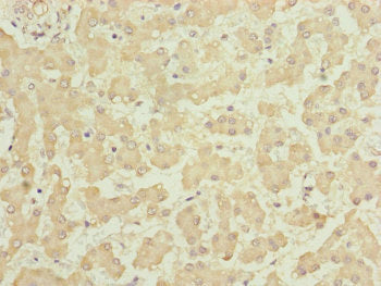 Immunohistochemistry of paraffin-embedded human liver tissue using HOOK2 Antibody at dilution of 1:100Rabbit anti-Human HOOK2 Polyclonal Antibody