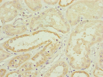 Immunohistochemistry of paraffin-embedded human kidney tissue using HOOK2 Antibody at dilution of 1:100Rabbit anti-Human HOOK2 Polyclonal Antibody