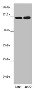 Western blot | All lanes: HOOK2 antibody at 4.11 μg/ml | Lane 1: Mouse small intestine tissue | Lane 2: A431 whole cell lysate | Secondary | Goat polyclonal to rabbit IgG at 1/10000 dilution | Predicted band size: 83 kDa | Observed band size: 83 kDaRabbit anti-Human HOOK2 Polyclonal Antibody