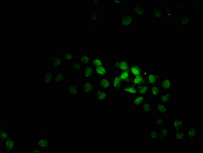 Immunofluorescence staining of Hela cells with KTI12 Antibody at 1:100, counter-stained with DAPI. The cells were fixed in 4% formaldehyde, permeabilized using 0.2% Triton X-100 and blocked in 10% normal Goat Serum. The cells were then incubated with the antibody overnight at 4°C. The secondary antibody was Alexa Fluor 488-congugated AffiniPure Goat Anti-Rabbit IgG(H+L).
