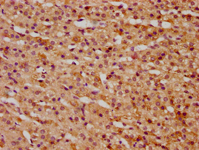 IHC image of KTI12 Antibody diluted at 1:300 and staining in paraffin-embedded human adrenal gland tissue performed on a Leica BondTM system. After dewaxing and hydration, antigen retrieval was mediated by high pressure in a citrate buffer (pH 6.0). Section was blocked with 10% normal goat serum 30min at RT. Then primary antibody (1% BSA) was incubated at 4°C overnight. The primary is detected by a biotinylated secondary antibody and visualized using an HRP conjugated SP system.
