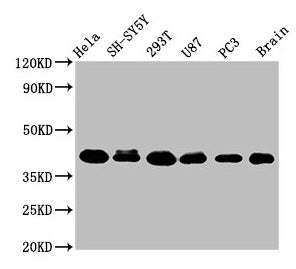 Western Blot  | Positive WB detected in: Hela whole cell lysate, SH-SY5Y whole cell lysate, 293T whole cell lysate, U87 whole cell lysate, PC-3 whole cell lysate, Rat brain tissue  | All lanes: KTI12 antibody at 3.2µg/ml  | Secondary  | Goat polyclonal to rabbit IgG at 1/50000 dilution  | Predicted band size: 39 kDa  | Observed band size: 39 kDa