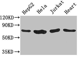 Western Blot | Positive WB detected in: HepG2 whole cell lysate, Hela whole cell lysate, Jurkat whole cell lysate, Mouse heart tissue | All lanes: CHFR antibody at 3.2μg/ml | Secondary | Goat polyclonal to rabbit IgG at 1/50000000 dilution | Predicted band size: 74, 73, 70, 64 kDa | Observed band size: 74 kDaRabbit anti-Human CHFR Polyclonal Antibody