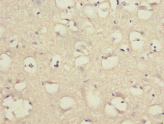 Immunohistochemistry of paraffin-embedded human brain tissue using LINGO1 Antibody at dilution of 1:100