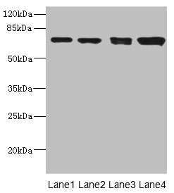 Western blot | All lanes: LINGO antibody at 3.12μg/ml | Lane 1: Mouse lung tissue | Lane 2: Jurkat whole cell lysate | Lane 3: A549 whole cell lysate | Lane 4: HL60 whole cell lysate | Secondary | Goat polyclonal to rabbit IgG at 1/10000 dilution | Predicted band size: 70 kDa | Observed band size: 70 kDa