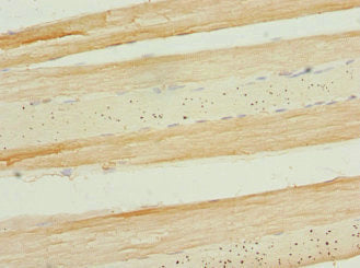 Immunohistochemistry of paraffin-embedded human skeletal muscle tissue using APIP Antibody at dilution of 1:100Rabbit anti-Human APIP Polyclonal Antibody