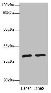 Western blot | All lanes: APIPantibody at 1.85μg/ml | Lane 1: Mouse heart tissue | Lane 2: Mouse kidney tissue | Secondary | Goat polyclonal to rabbit IgG at 1/10000 dilution | Predicted band size: 28, 23 kDa | Observed band size: 28 kDaRabbit anti-Human APIP Polyclonal Antibody