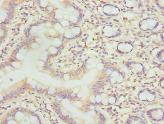 Immunohistochemistry of paraffin-embedded human small intestine tissue using LLCFC1 Antibody at dilution of 1:100