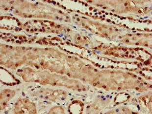 Immunohistochemistry of paraffin-embedded human kidney tissue using GUCD1 Antibody at dilution of 1:100Rabbit anti-Human GUCD1 Polyclonal Antibody