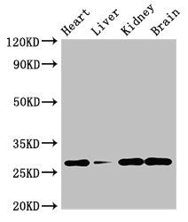 Western Blot | Positive WB detected in: Mouse heart tissue, Mouse liver tissue, Mouse kidney tissue, Mouse brain tissue | All lanes: GUCD1 antibody at 4μg/ml | Secondary | Goat polyclonal to rabbit IgG at 1/50000 dilution | Predicted band size: 28, 34 kDa | Observed band size: 28 kDaRabbit anti-Human GUCD1 Polyclonal Antibody